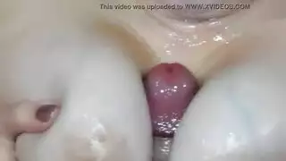 التبول نائب الرئيس المغطاة الدهون ناضجة